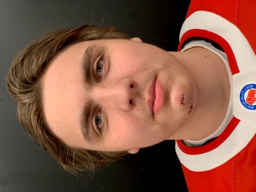 Brandon Patterson Brandon Patterson